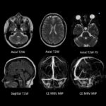 Weekly Image Challenge – November 30, 2024