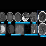 Weekly Image Challenge – January 11, 2025